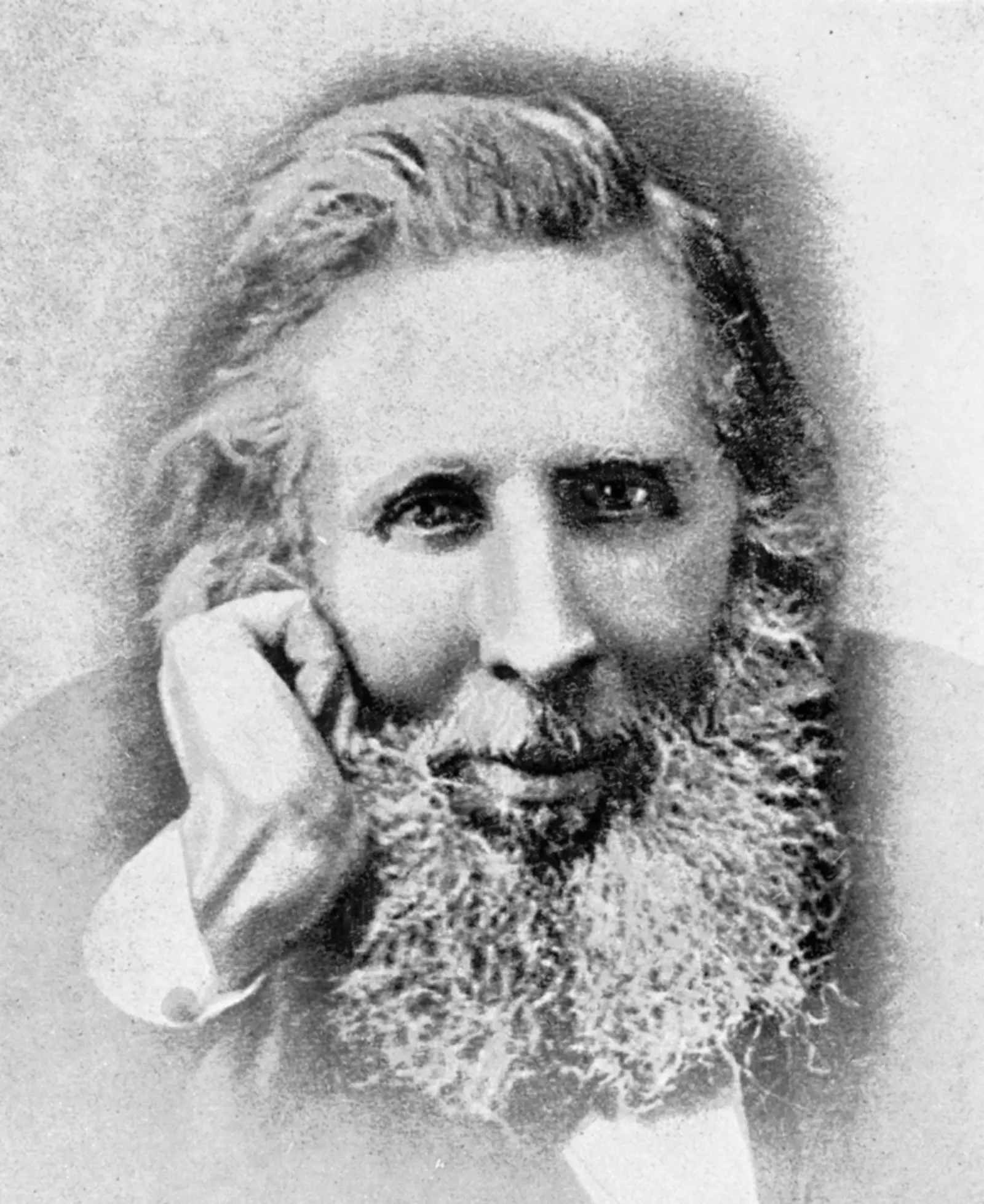 Sir William Robert Wills Wilde MD, FRCSI, (March 1815 – 19 April 1876)